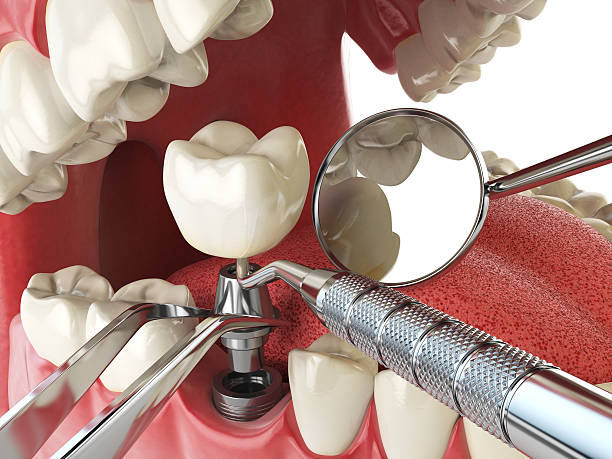 Best Knocked-Out Tooth Emergency  in Weedsport, NY